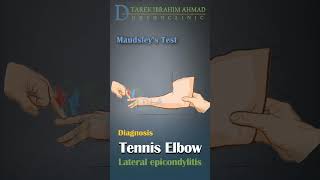 how you know if you have tennis elbow [upl. by Nnylrefinnej]