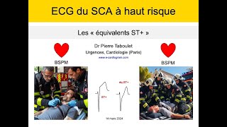 ECG du syndrome coronaire aigu Les équivalents ST à haut risque P Taboulet [upl. by Atnomed310]