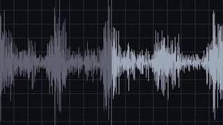 AV Fistula Recording amp Waveform  Eko Health [upl. by Rhtaeh]