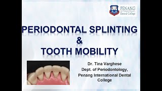 Periodontal Splinting amp Tooth mobility [upl. by Emoraj]