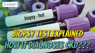 What Is Biopsy Test amp How It Helps In Diagnosing Chronic Kidney Disease  CKD Testing [upl. by Enenstein]