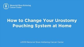 How to Change Your Urostomy Pouching System at Home [upl. by Adnorat]