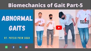 Antalgic gait Hemiplegic gait All Abnormal Gait Demonstration Gait biomechanics [upl. by Mw]