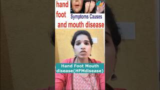 Hand Foot Mouth diseaseHFMdiseasetrending shorts hfmd handfootmouthdisease tomatoflu telugu [upl. by Ysnil]