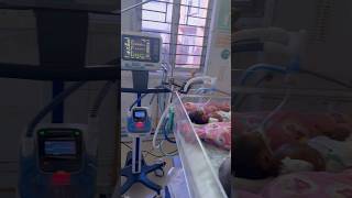 Newborn baby on ventilation in SNCUNICU sncu nicubaby nicu [upl. by Olonam798]