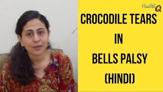 What are crocodile tears in Bells Palsy HINDI [upl. by Nacim]