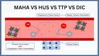 MAHA vs HUS vs TTP vs DIC [upl. by Esinej]