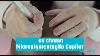 O que é Micropigmentação Capilar [upl. by Pownall]