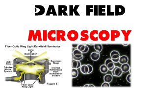 Dark field microscopy [upl. by Lemyt]