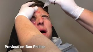 Ben Phillips Pranks Ive basically been pranked wow [upl. by Elliot746]