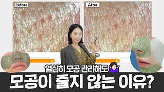 Eng 모공 줄이는 성분 4가지 👍수부지 피부의 모공 순삭 꿀조합템 공개 by 디렉터파이 [upl. by Akkin]