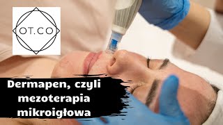 Dermapen czyli mezoterapia mikroigłowa kosmetolog odpowiada  OTCO Clinic [upl. by Armilda961]