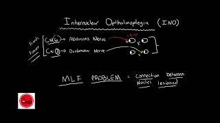 Internuclear ophthalmoplegia INO BASIC amp QUICK EXPLANATION [upl. by Ozzy]