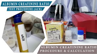 ALBUMIN CREATININE RATION ACR How to Microalbumin Test amp Urine Creatinine Test Procedure [upl. by Entruoc801]