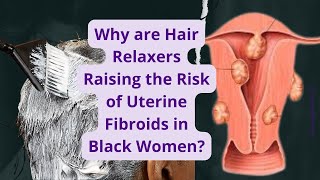 quotAre Hair Relaxers Linked to Uterine Fibroids Uncovering the Risks for AfricanAmerican Womenquot [upl. by Hermes426]