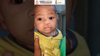 Cleft Lip amp Palate free amp👌😊successful surgery Smile train Anand Hospital Meerut UP Ravindra Saini [upl. by Nekal]