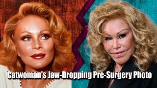 Catwoman Jocelyn Wildensteins Stunning PreSurgery Look Revealed [upl. by Tate]