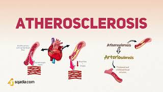 Atherosclerosis Physiology Pathophysiology and Pathogenesis [upl. by Ulrica]