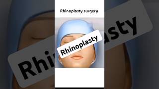 Rhinoplasty surgery shorts mbbs medical rhinoplasty [upl. by Seymour]