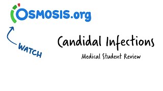 Candidal Infections Osmosis Study Video [upl. by Sela169]