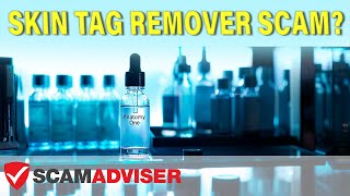 Anatomy One Skin Tag Remover Red Flags amp Reviews You Need To See Before Ordering It [upl. by Nnaegroeg760]