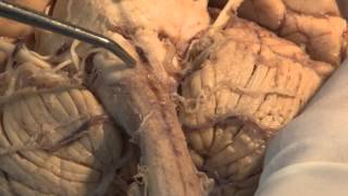 The Visual Pathway Neuroanatomy Video Lab  Brain Dissections [upl. by Ynney]