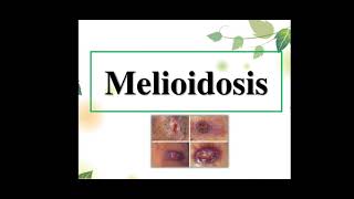 Melioidosis [upl. by Reede]