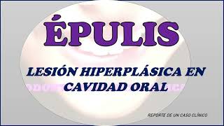 ÉPULIS  Lesión Hiperplásica en Cavidad Oral [upl. by Dnomhcir]