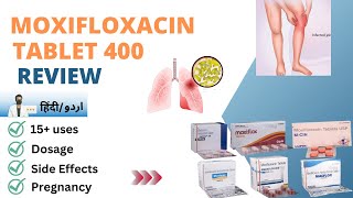 Moxifloxacin Hydrochloride Tablets 400 mg  Moxifloxacin 400 mg Tablet Uses in हिंदीاردو [upl. by Randie]