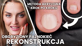 Rekonstrukcja paznokcia akrylem Jak naprawić obgryzione paznokcie krok po kroku  Indigo Nails [upl. by Nimesay984]