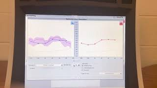 Hearing loss simulation with Speech Intelligibility Index of 39 Mild to moderate [upl. by Aisemaj]