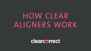 How clear aligners work [upl. by Nnhoj456]