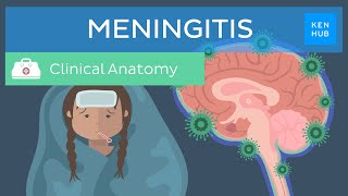 Meningitis Causes symptoms treatment  Kenhub [upl. by Ydwor939]