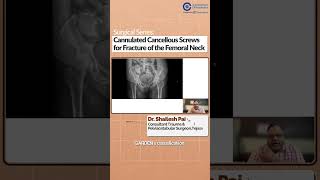 Cannulated Cancellous Screws for Femoral Neck Fractures  Dr Shailesh Pai  Surgical Series [upl. by Atlee180]