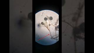 Mucor  mold  Saprophytic  fungus c³ experiment [upl. by Vasily]