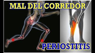 EJERCICIOS para evitar y tratar la PERIOSTITIS TIBIAL o MAL DEL CORREDOR [upl. by Arikat]