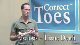 Plantar Fasciitis or Fasciosis [upl. by Ivets]