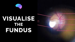 Fundoscopy  How to Visualise the Fundus  Direct Ophthalmoscopy  OSCE Guide  UKMLA  CPSA [upl. by Gnok]