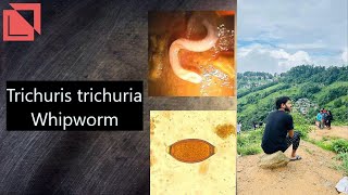 parasitology Trichuris trichura Whipworm norcet microbiology labtechnician mltlab [upl. by Ginger]