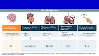 Connective tissue disease associated pulmonary hypertension Prof Mostafa Elshazly Chest Kasr ElAini [upl. by Marceau539]