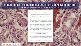 Lungenembolie Thrombektomie ist Lyse im direkten Vergleich überlegen [upl. by Colleen]