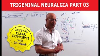 Trigeminal Neuralgia  Causes and Treatment  Part 3 [upl. by Rae252]