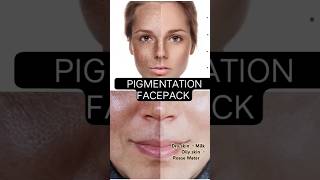 PIGMENTATION PACK gonaturesoap [upl. by Nehgaem]