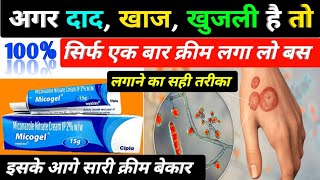 दाद खाज खुजली की बेस्ट क्रीम  micogel cream  micogel cream uses in hindi  miconazole nitrate [upl. by Lashond850]