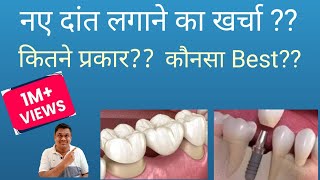 नए दांत लगाने का खर्चा डेंटल इंप्लांट या डेंटल ब्रिज Dental Implants Vs Dental Bridge Cost [upl. by Trinl80]