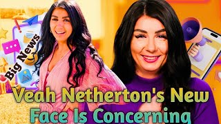 90 Day Fiancé Veah Nethertons New Face Is Concer [upl. by Nosahc470]