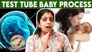 Test Tube Baby Treatment Tamil  Dr Deepthi JammiCwc  IVF procedure  infertility fertility [upl. by Dlaniger]