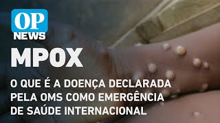 Mpox o que é a doença sintomas como transmite vacina l O POVO NEWS [upl. by Rosen]