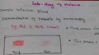 Laboratory Diagnosis of Malaria [upl. by Jarid]