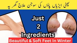 Crack Heels Treatment at Home پھٹی ایڑیاں بنائیں نرم و نازک اب گھر پہ [upl. by Casia300]